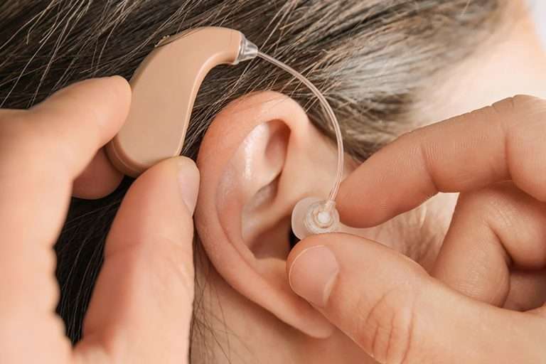 Top 10 Best Hearing Aids 2024